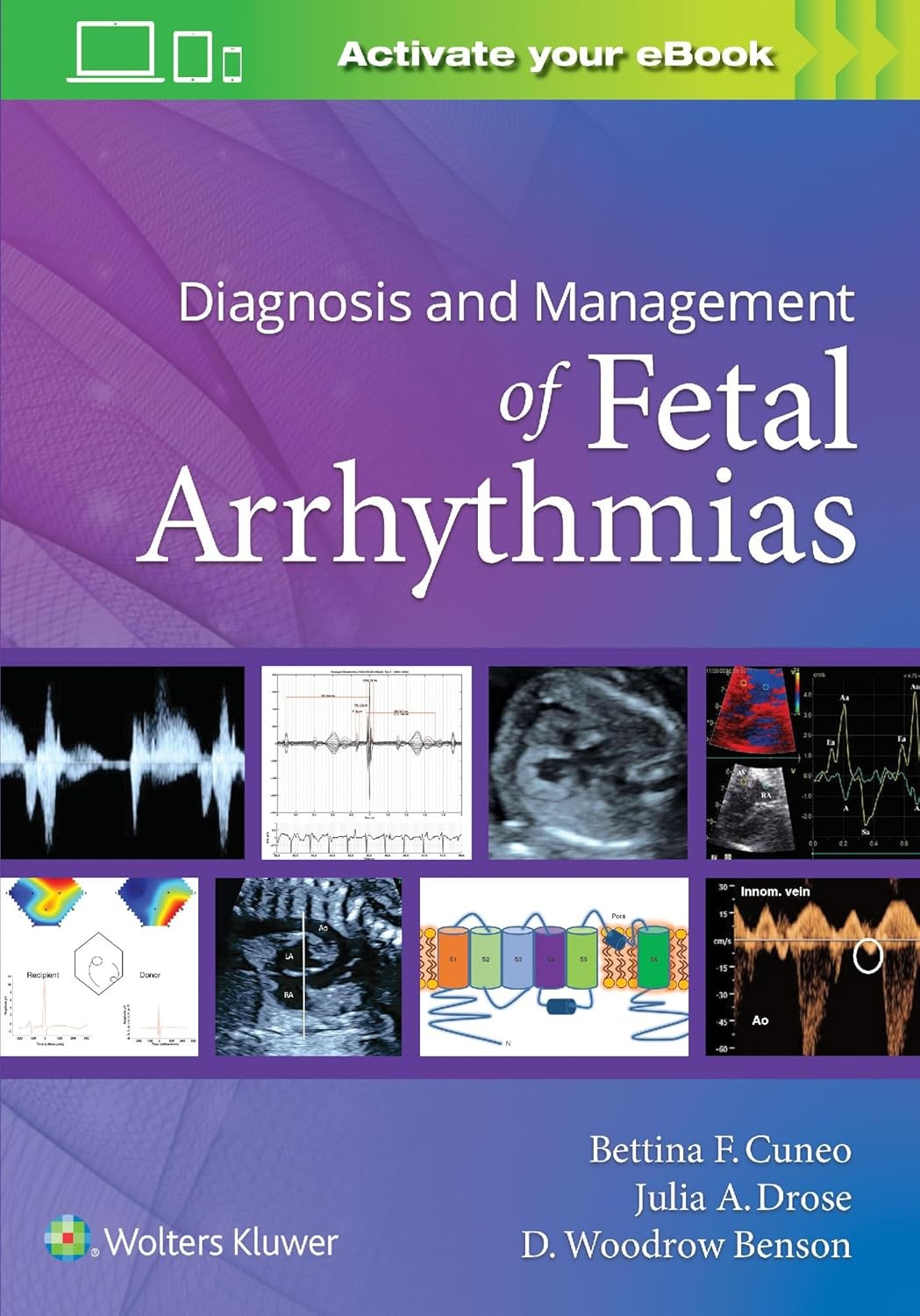 Diagnosis And Management Of Fetal Arrhythmias