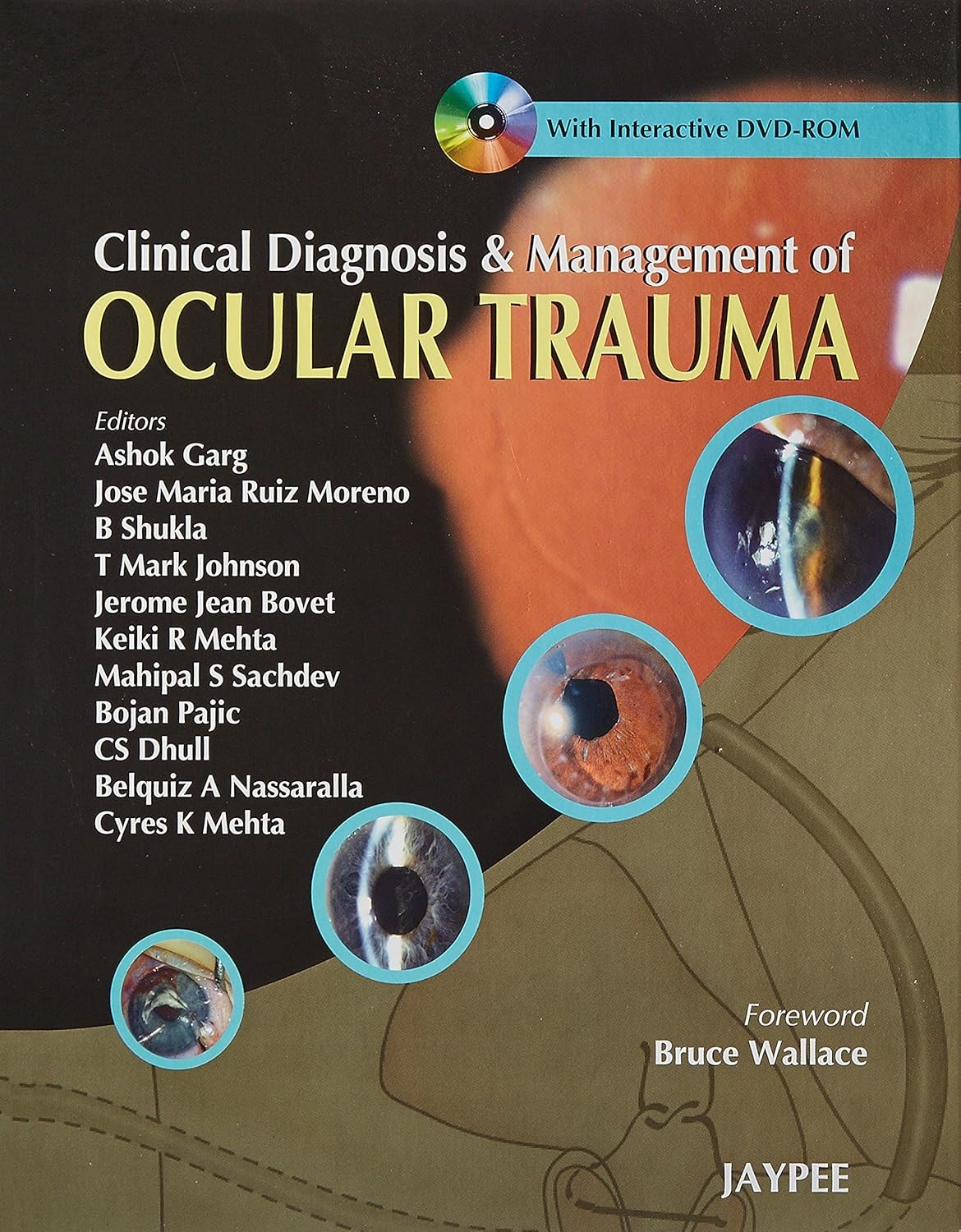 Ocular Trauma Clinical Diag.& Management With Int.Dvd-Rom